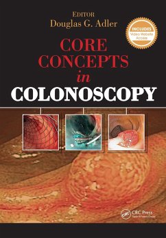 Core Concepts in Colonoscopy (eBook, ePUB) - Adler, Douglas