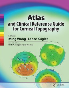 Atlas and Clinical Reference Guide for Corneal Topography (eBook, PDF) - Wang, Ming; Kugler, Lance Atlas and Clinical Reference Guide for Corneal Topography (eBook, PDF) - Wang, Ming; Kugler, Lance