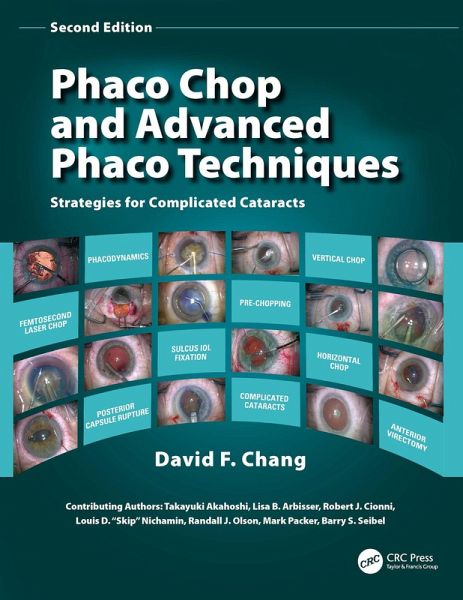 Phaco Chop and Advanced Phaco Techniques (eBook, PDF)