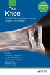 The Knee (eBook, ePUB) - Bild 1