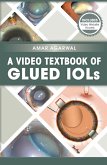 A Video Textbook of Glued IOLs (eBook, ePUB) A Video Textbook of Glued IOLs (eBook, ePUB)
