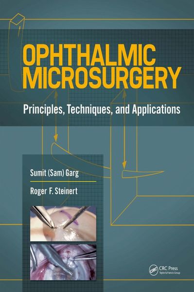 Ophthalmic Microsurgery (eBook, PDF) Ophthalmic Microsurgery (eBook, PDF)