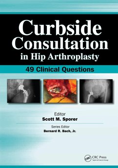 Curbside Consultation in Hip Arthroplasty (eBook, ePUB) - Sporer, Scott