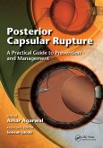 Posterior Capsular Rupture (eBook, ePUB) Posterior Capsular Rupture (eBook, ePUB)