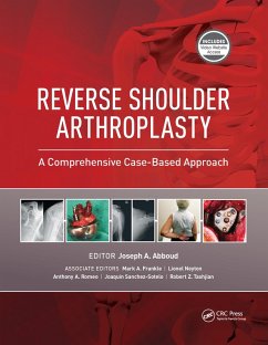 Cover Reverse Shoulder Arthroplasty (eBook, ePUB)