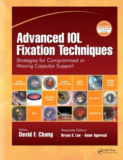 Cover Advanced IOL Fixation Techniques (eBook, PDF)