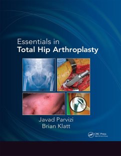 Essentials in Total Hip Arthroplasty (eBook, PDF) - Parvizi, Javad; Klatt, Brian