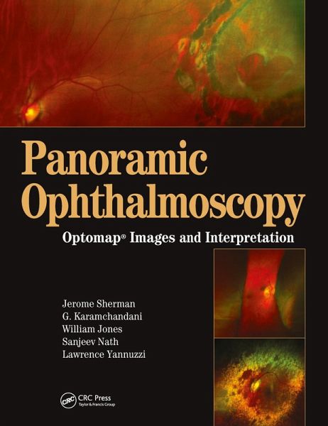 Panoramic Ophthalmoscopy (eBook, ePUB) Panoramic Ophthalmoscopy (eBook, ePUB)