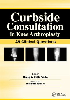 Cover Curbside Consultation in Knee Arthroplasty (eBook, ePUB)