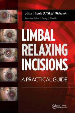 Limbal Relaxing Incisions (eBook, PDF) - Nichamin, Louis