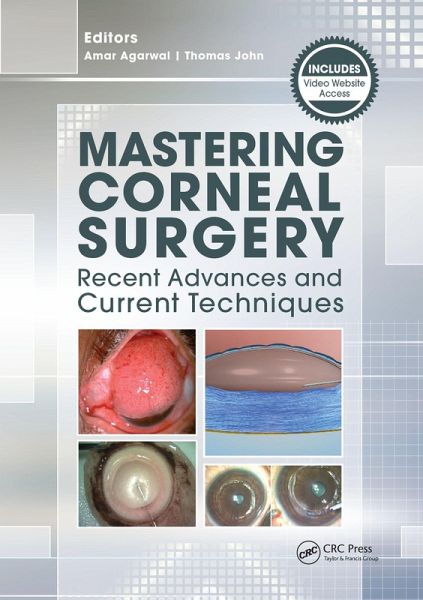 Mastering Corneal Surgery (eBook, ePUB) Mastering Corneal Surgery (eBook, ePUB)