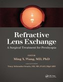 Refractive Lens Exchange (eBook, ePUB)