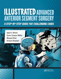 Illustrated Advanced Anterior Segment Surgery (eBook, ePUB) - Ahmed, Iqbal; Möller, Xavier; Shah, Manjool; Sheybani, Arsham