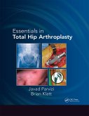 Essentials in Total Hip Arthroplasty (eBook, ePUB) Essentials in Total Hip Arthroplasty (eBook, ePUB)
