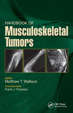 Handbook of Musculoskeletal Tumors (eBook, ePUB) - Wallace, Matthew; Frassica, Frank