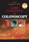 Core Concepts in Colonoscopy (eBook, PDF) Core Concepts in Colonoscopy (eBook, PDF)