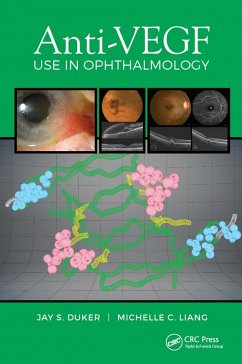 Cover Anti-VEGF Use in Ophthalmology (eBook, ePUB)