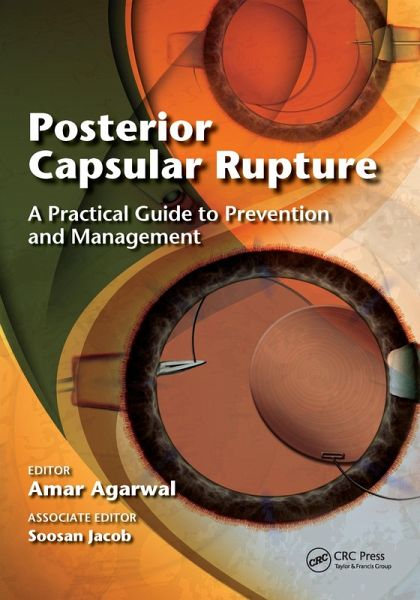 Posterior Capsular Rupture (eBook, PDF)