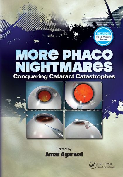 More Phaco Nightmares (eBook, ePUB) More Phaco Nightmares (eBook, ePUB)