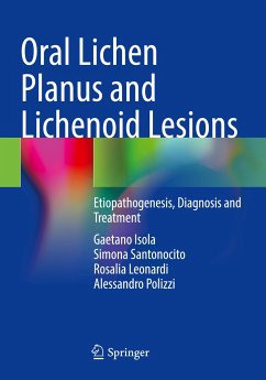 Oral Lichen Planus and Lichenoid Lesions - Isola, Gaetano;Santonocito, Simona;Leonardi, Rosalia