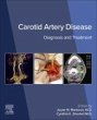 Carotid Artery Disease - Bild 1