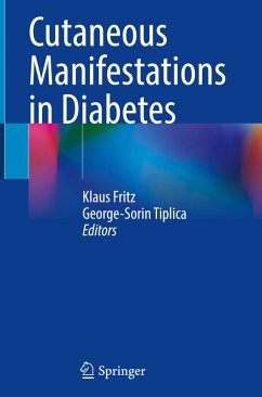 Cover Cutaneous Manifestations in Diabetes