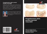 Progettazione delle protesi parziali rimovibili