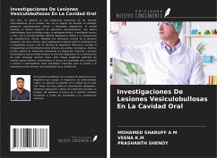 Investigaciones De Lesiones Vesiculobullosas En La Cavidad Oral - Sharuff A M, Mohamed; K. M, Veena; Shenoy, Prashanth