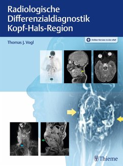 Radiologische Differenzialdiagnostik Kopf-Hals-Region (eBook, ePUB)
