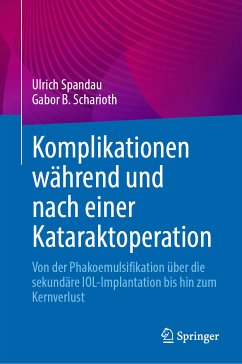 Komplikationen während und nach einer Kataraktoperation (eBook, PDF) - Spandau, Ulrich; Scharioth, Gabor B.