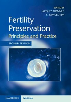 Fertility Preservation (eBook, PDF)