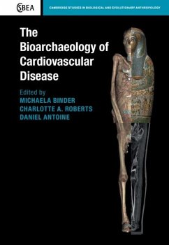 Cover Bioarchaeology of Cardiovascular Disease (eBook, PDF)