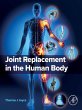 Joint Replacement in the Human Body... - Bild 1