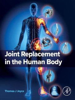 Cover Joint Replacement in the Human Body (eBook, ePUB)
