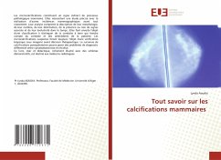 Tout savoir sur les calcifications mammaires - Aoudia, Lynda