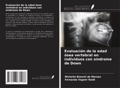 Evaluación de la edad ósea vertebral en individuos con síndrome de Down - Bianchi de Moraes, Michelle; Vagner Raldi, Fernando