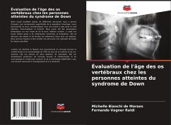 Évaluation de l'âge des os vertébraux chez les personnes atteintes du syndrome de Down - Bianchi de Moraes, Michelle;Vagner Raldi, Fernando