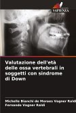 Valutazione dell'età delle ossa vertebrali in soggetti con sindrome di Down