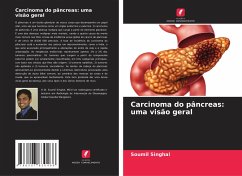 Carcinoma do pâncreas: uma visão geral - Singhal, Soumil