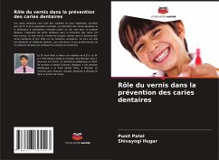 Rôle du vernis dans la prévention des caries dentaires - Patel, Punit;Hugar, Shivayogi