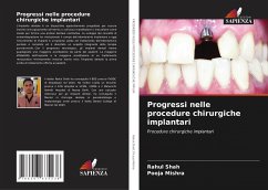 Progressi nelle procedure chirurgiche implantari - Shah, Rahul;Mishra, Pooja