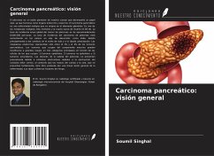 Carcinoma pancreático: visión general - Singhal, Soumil