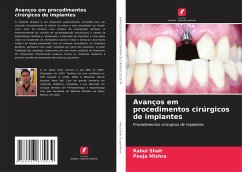 Avanços em procedimentos cirúrgicos de implantes - Shah, Rahul;Mishra, Pooja