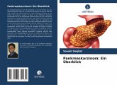 Pankreaskarzinom: Ein Überblick