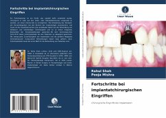 Fortschritte bei implantatchirurgischen Eingriffen - Shah, Rahul;Mishra, Pooja