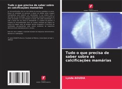 Tudo o que precisa de saber sobre as calcificações mamárias - Aoudia, Lynda