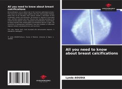 All you need to know about breast calcifications - Aoudia, Lynda