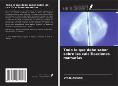 Todo lo que debe saber sobre las calcificaciones mamarias - Aoudia, Lynda