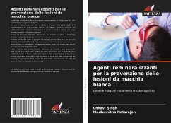 Agenti remineralizzanti per la prevenzione delle lesioni da macchia bianca - Singh, Chhavi;Natarajan, Madhumitha