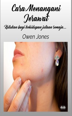 Cara Menangani Jerawat - Jones, Owen